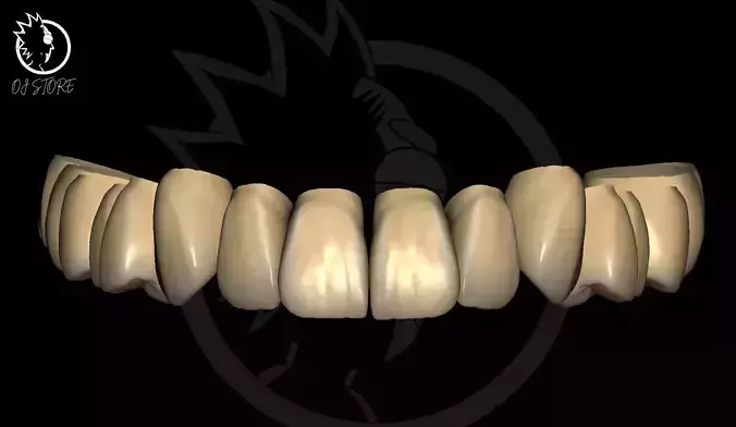 OJ RickXenoon Exocad Library