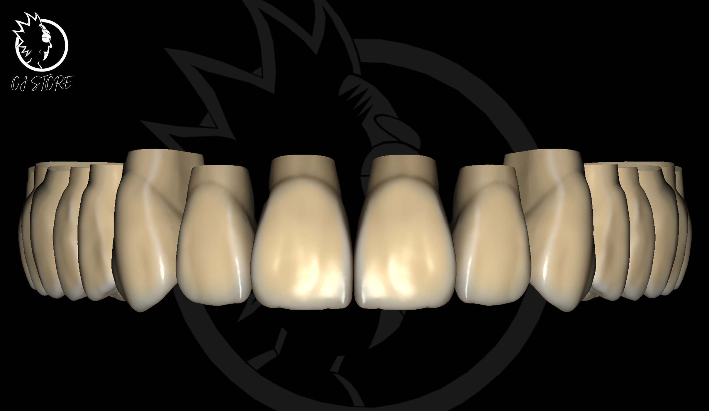 OJ RICKGREN DESIGN 2024 Exocad Library 3D print model_4