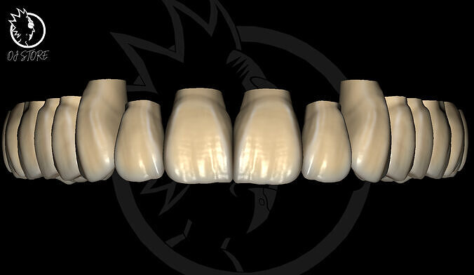OJ RICKGREN DESIGN 2025 Exocad Library 3D print model