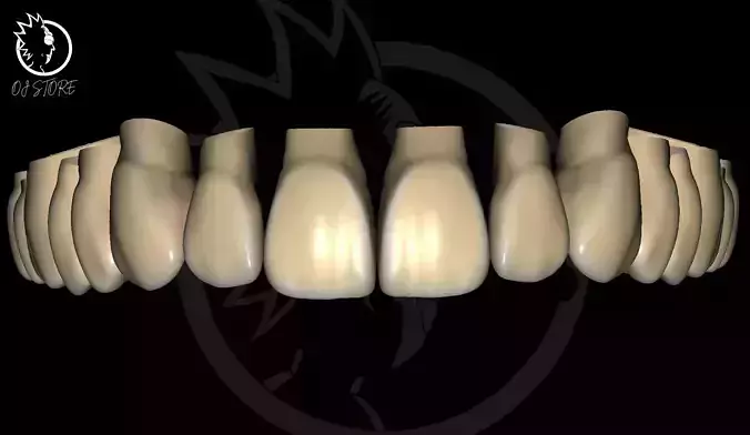 OJ RICKGren DESIGN 2025 NEW Exocad Library