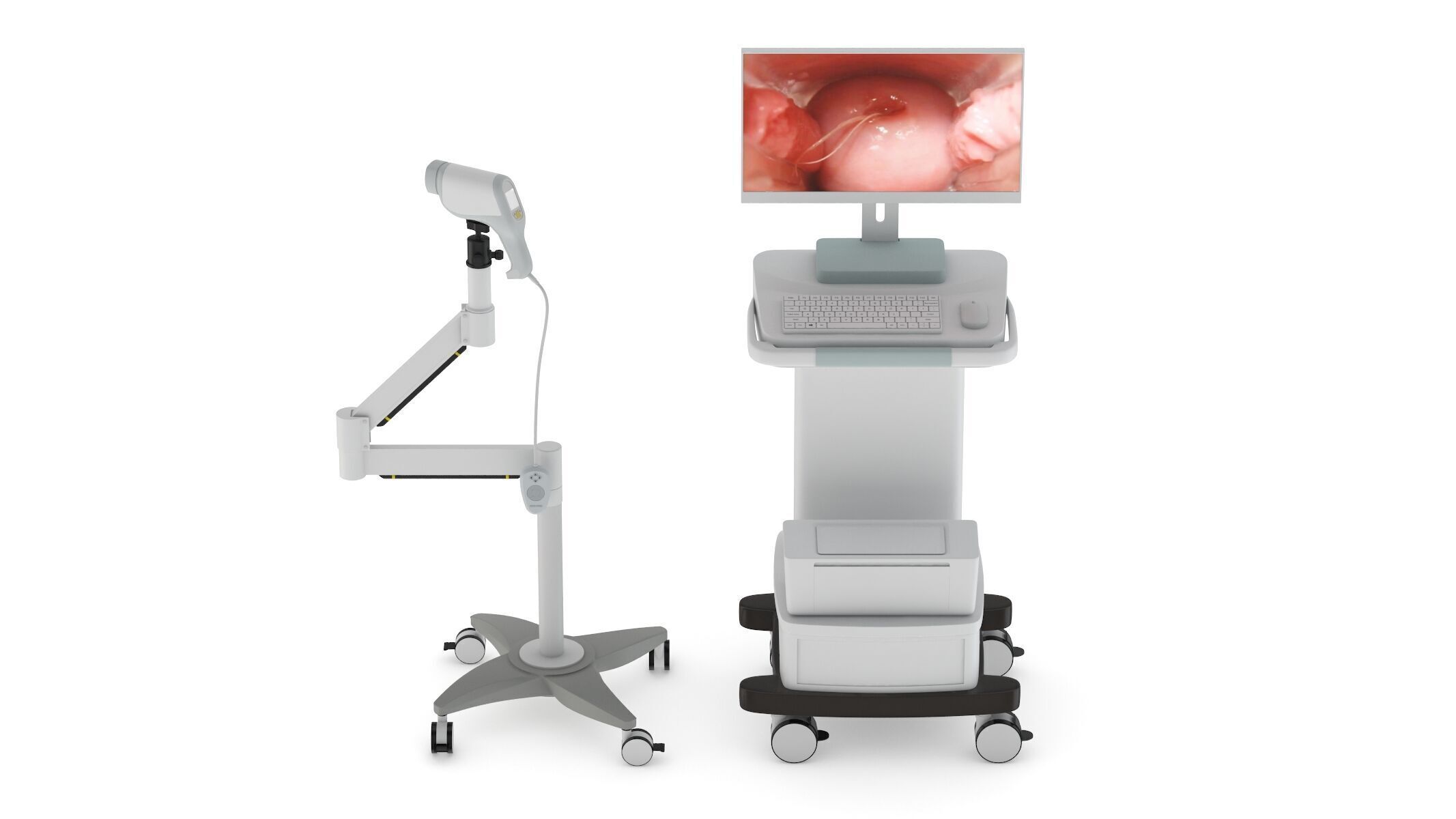 36 Models Medical Treatment Equipment 3D model_13