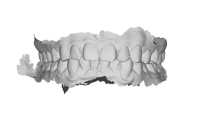 P003 - Dental - Intraoral Scan STL-PLY-OBJ