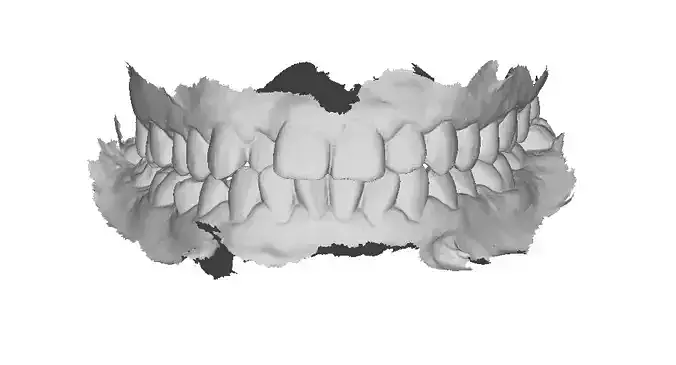 P004 - Dental - Intraoral Scan STL-PLY-OBJ
