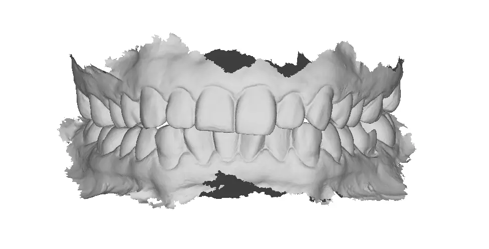 P005 - Dental - Intraoral Scan STL-PLY-OBJ 3D print model