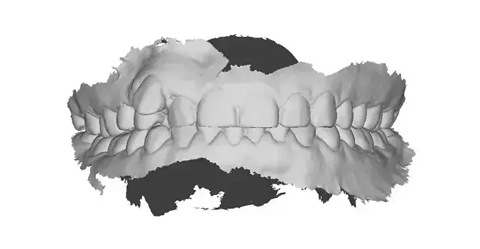 P006 - Dental - Intraoral Scan STL-PLY-OBJ