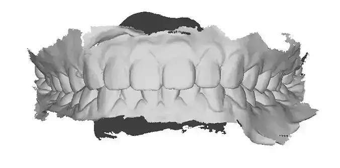 P008 - Dental - Intraoral Scan STL-PLY-OBJ