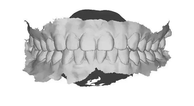 P009 - Dental - Intraoral Scan STL-PLY-OBJ 3D print model
