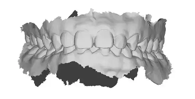 P010 - Dental - Intraoral Scan STL-PLY-OBJ