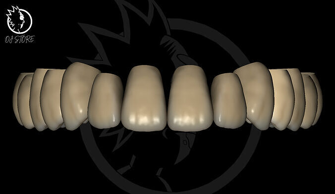 OJ RICKAshortia EXOCAD Library Free 3D model