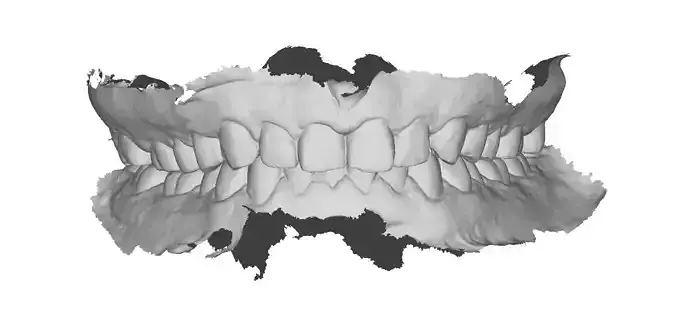 P011 - Dental - Intraoral Scan STL-PLY-OBJ