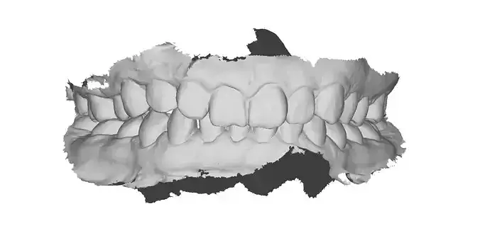 P012 - Dental - Intraoral Scan STL-PLY-OBJ