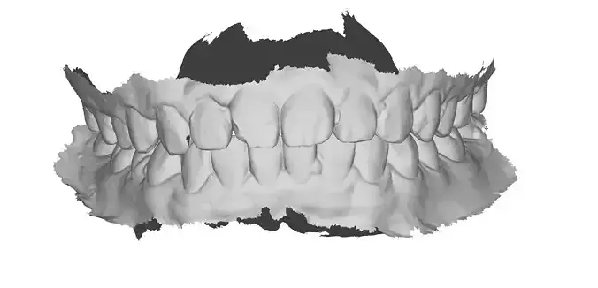 P013 - Dental - Intraoral Scan STL-PLY-OBJ