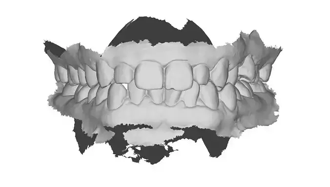 P015 - Dental - Intraoral Scan STL-PLY-OBJ