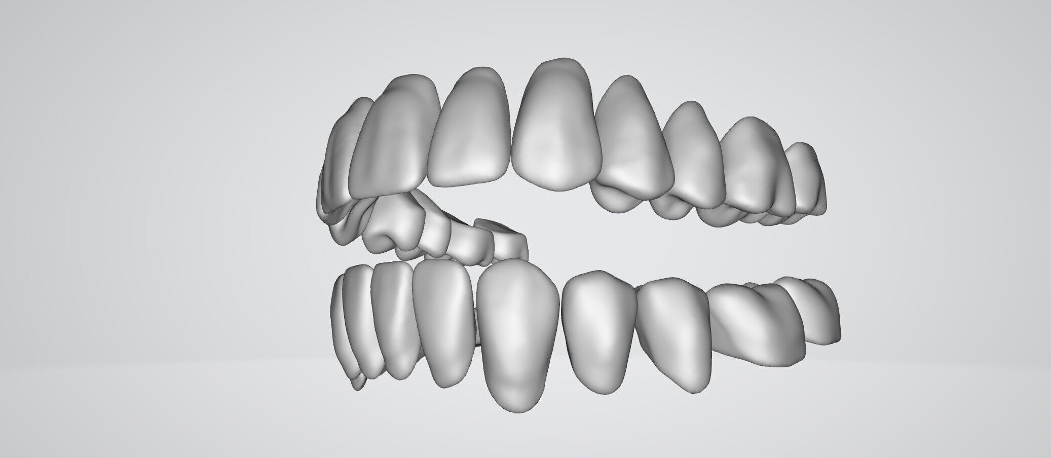 Ultra-Detailed Anatomically Correct Human Teeth Set 3D print model_8