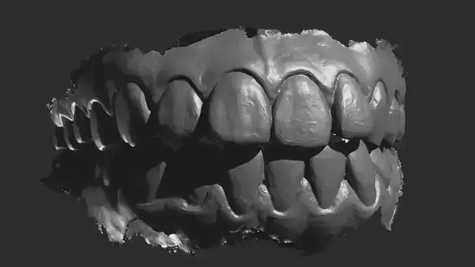3D Printable Dental Models - Upper and Lower Jaw STL Files 