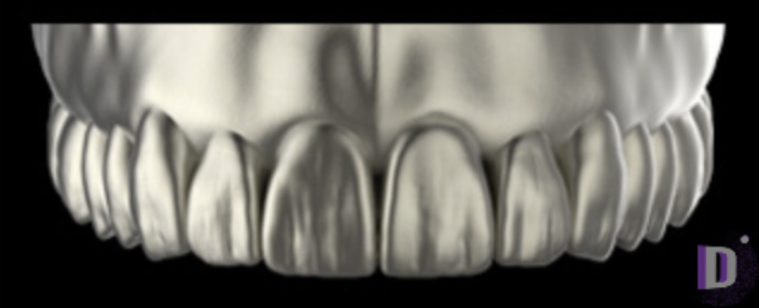 The complete set of 36 Expression dental libraries - Exocad Low-poly 3D model_3