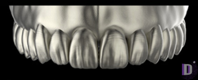 The complete set of 36 Expression dental libraries - Exocad Low-poly 3D model_10