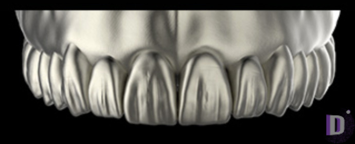 The complete set of 36 Expression dental libraries - Exocad Low-poly 3D model_50