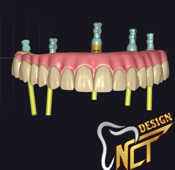 Dental Crown - Teeth upper and lower Low-poly 3D model_2