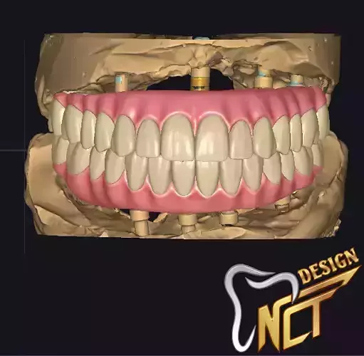 Dental Crown - Teeth upper and lower Low-poly 3D model