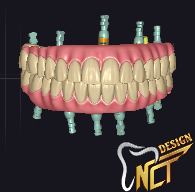 Dental Crown - Teeth upper and lower Low-poly 3D model_1