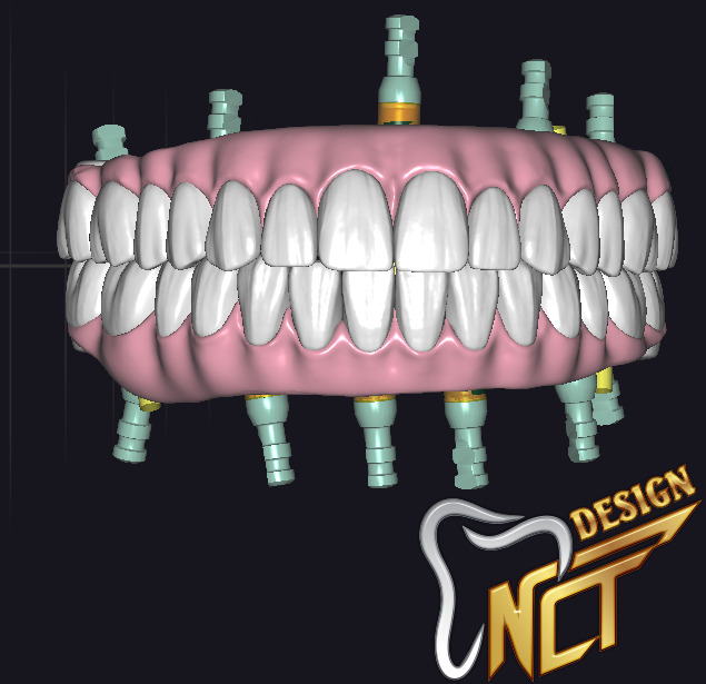 Dental Crown - Teeth upper and lower Low-poly 3D model_5