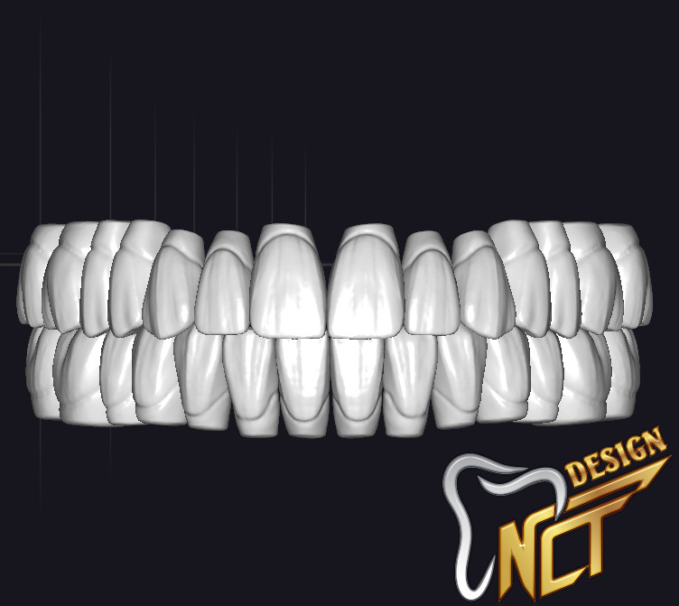 Dental Crown - Teeth upper and lower Low-poly 3D model_12