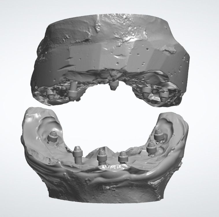 Dental Crown - Teeth upper and lower Low-poly 3D model_9