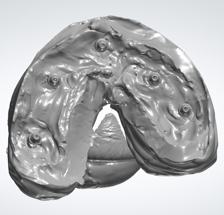 Dental Crown - Teeth upper and lower Low-poly 3D model_10
