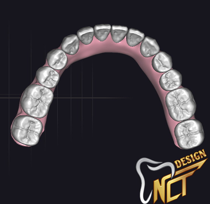 Dental Crown - Teeth upper and lower Low-poly 3D model_4