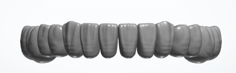 3Shape Library NCT-Design-Ver1 Low-poly 3D model_2