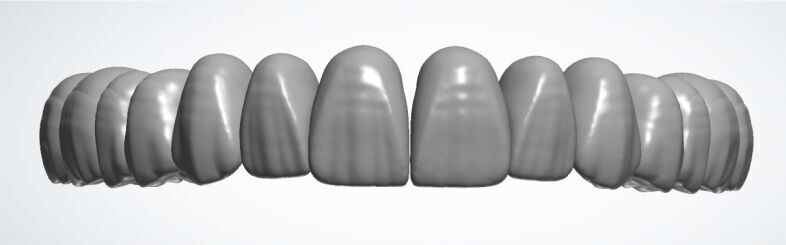 3Shape Library NCT-Design-Ver1 Low-poly 3D model_1