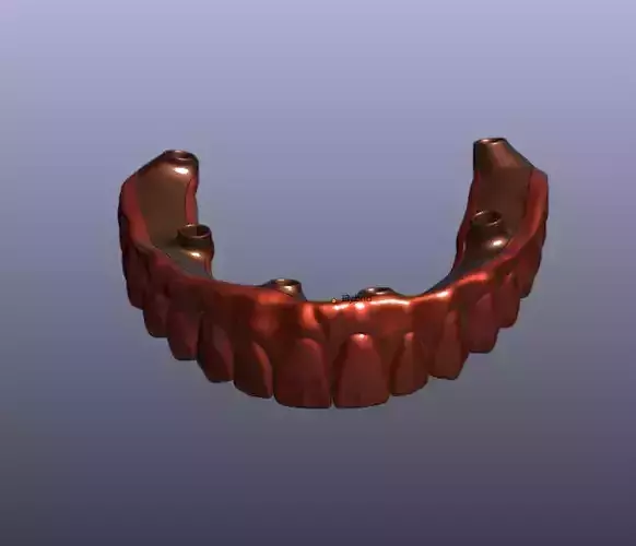 The hybrid - stl file of the upper jaw 3D print model