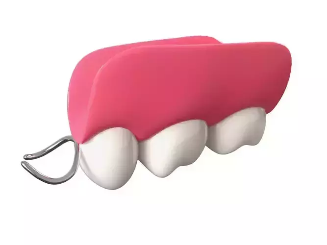 Removable Partial Denture