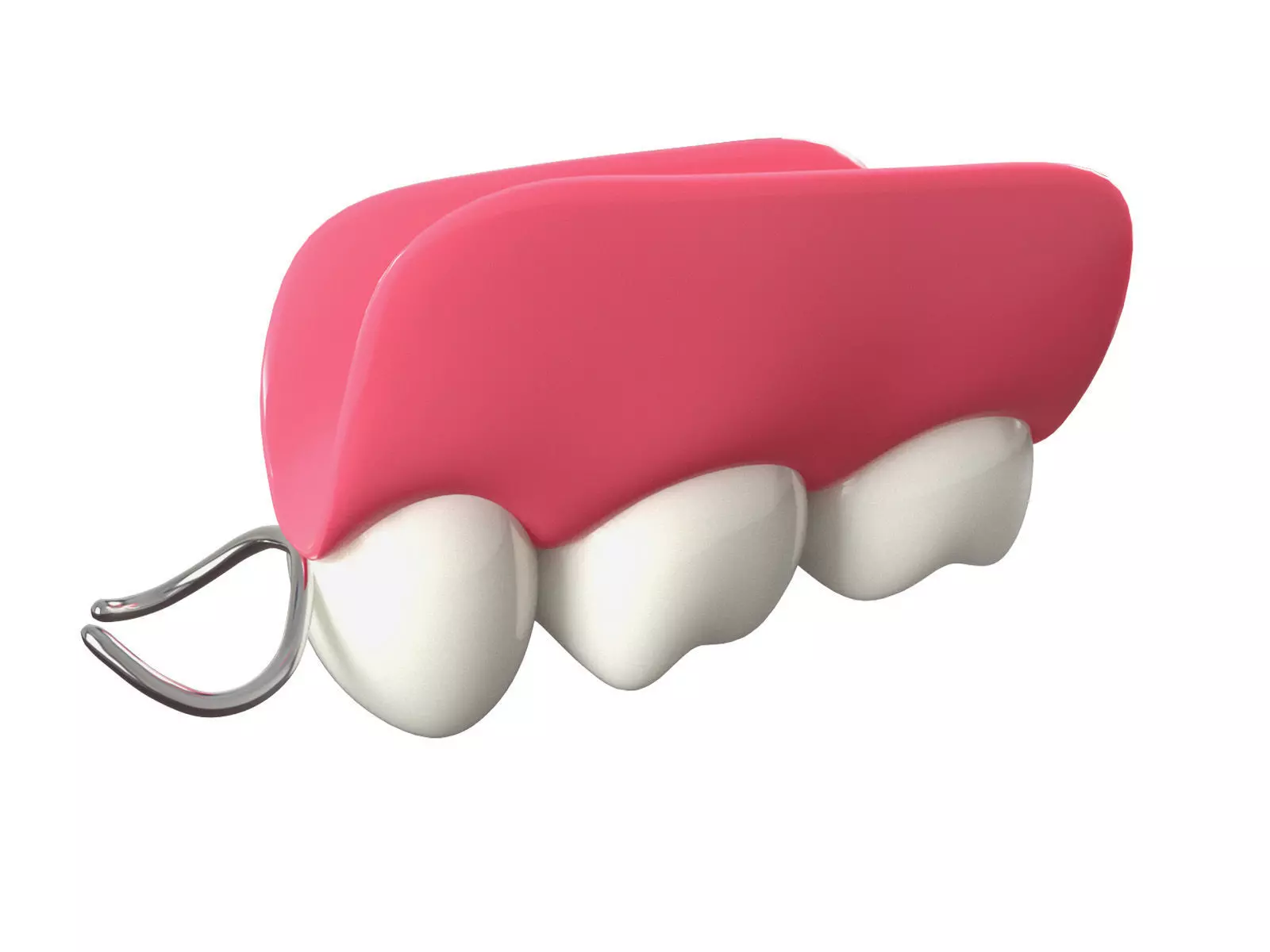 Removable Partial Denture Low-poly 3D model