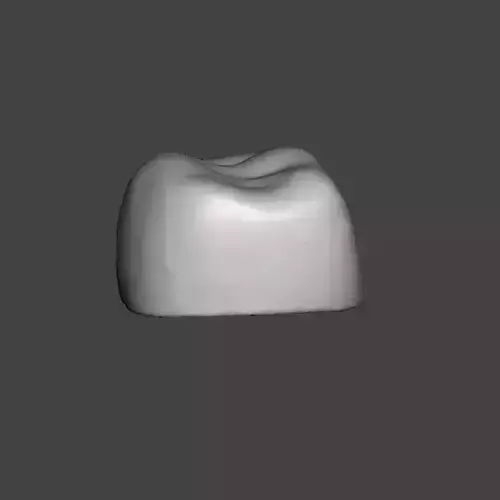 Pediatric readymade crowns Upper Primary First Molar 3D print model