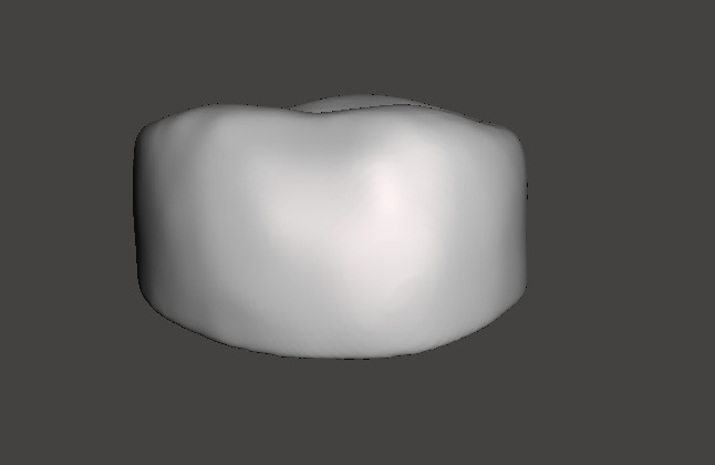 Pediatric readymade crowns Upper Primary Second Molar 3D print model_1