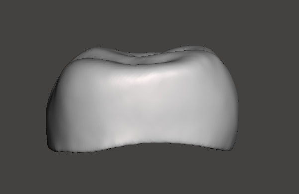 Pediatric readymade crowns Upper Primary Second Molar 3D print model_2