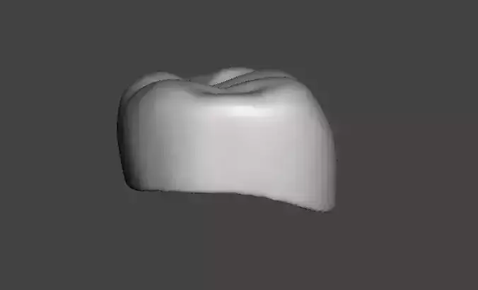 Pediatric readymade crowns Lower Primary Second Molar 3D print model