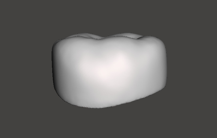 Pediatric readymade crowns Lower Primary Second Molar 3D print model_1