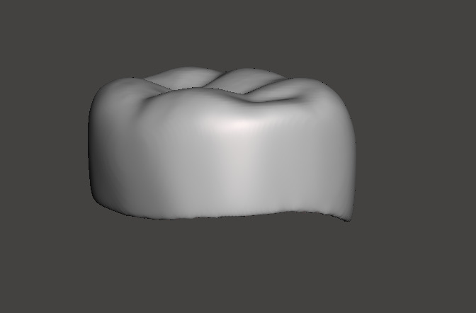 Pediatric readymade crowns Lower Primary Second Molar 3D print model_2
