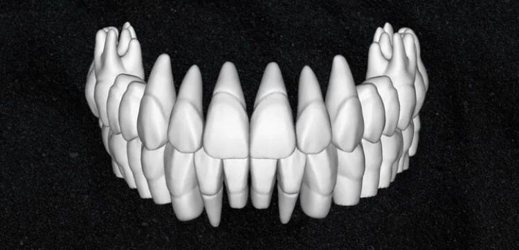 The complete set of - 34 Grin Design dental libraries - Exocad Low-poly 3D model_31