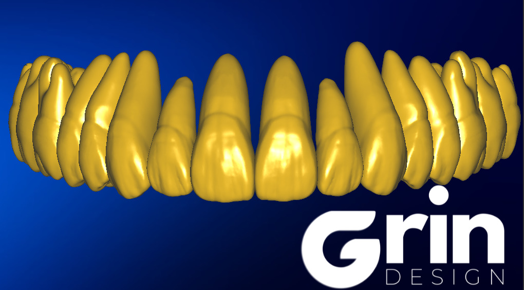 The complete set of - 34 Grin Design dental libraries - Exocad Low-poly 3D model_19