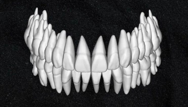 The complete set of - 34 Grin Design dental libraries - Exocad Low-poly 3D model_32