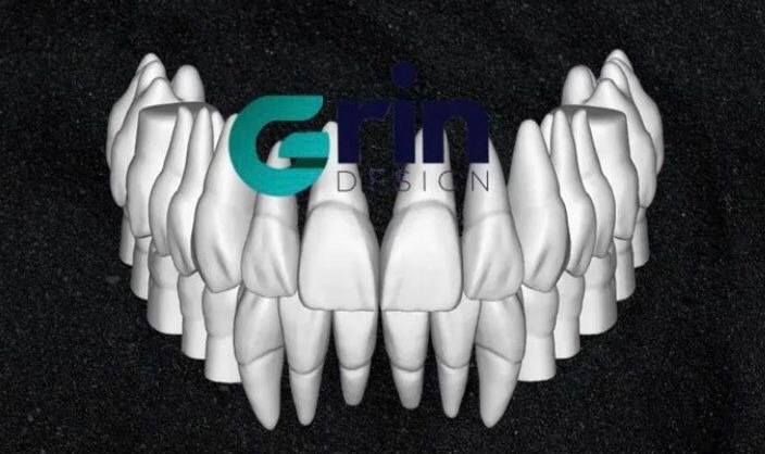 The complete set of - 34 Grin Design dental libraries - Exocad Low-poly 3D model_34