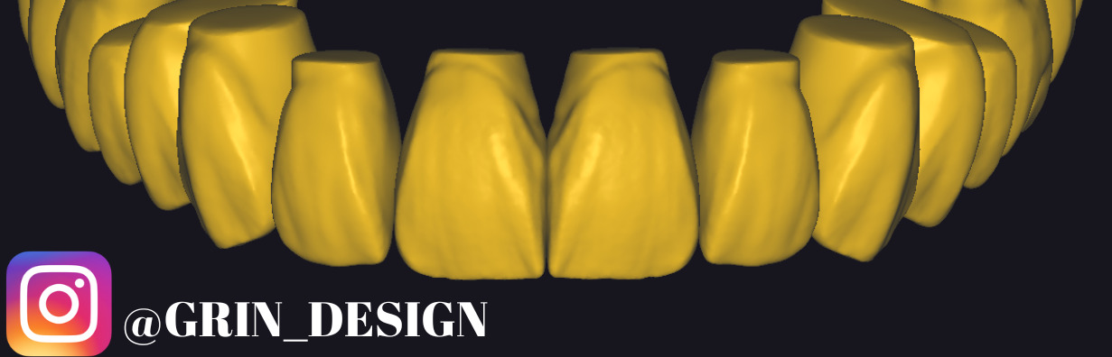 The complete set of - 34 Grin Design dental libraries - Exocad Low-poly 3D model_11
