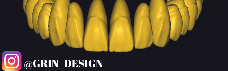 The complete set of - 34 Grin Design dental libraries - Exocad Low-poly 3D model_15
