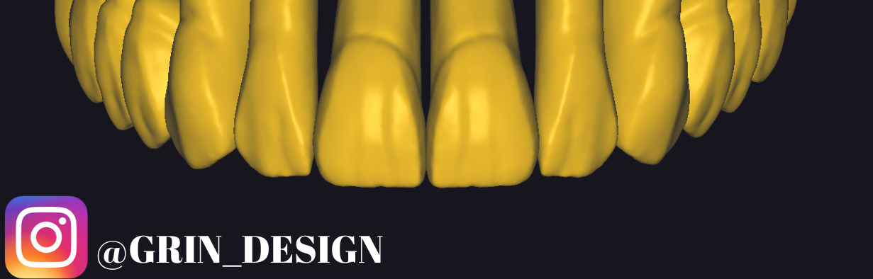 The complete set of - 34 Grin Design dental libraries - Exocad Low-poly 3D model_12