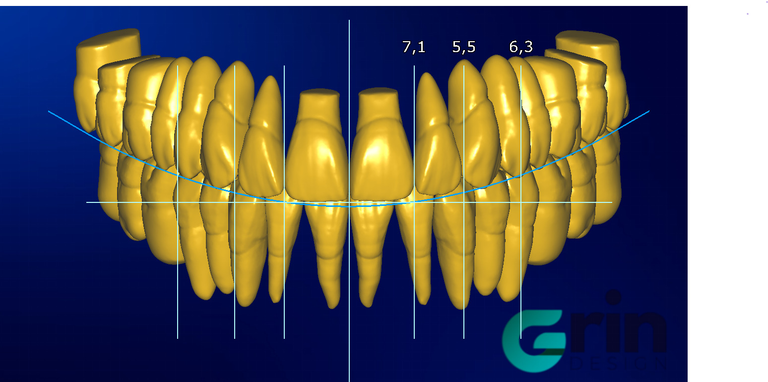 The complete set of - 34 Grin Design dental libraries - Exocad Low-poly 3D model_6