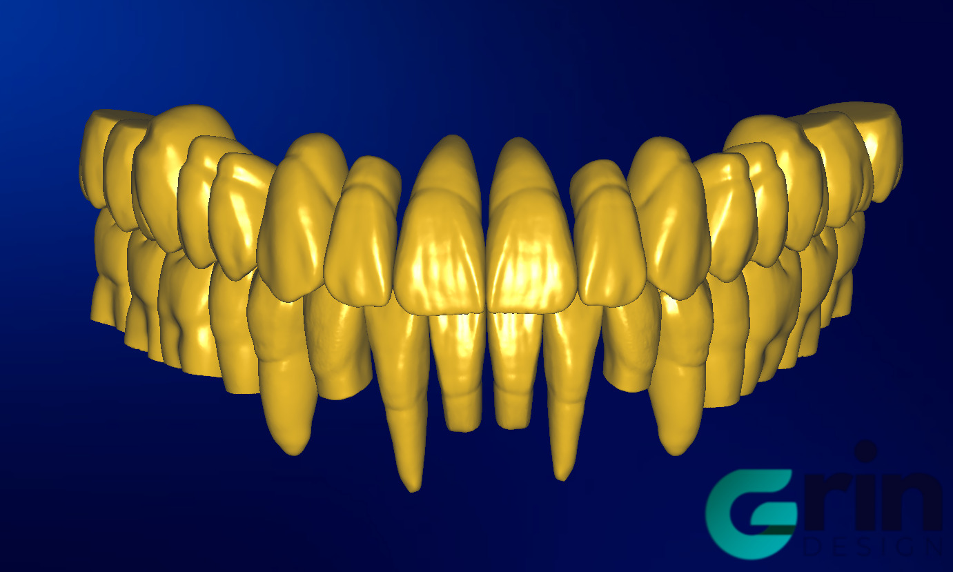 The complete set of - 34 Grin Design dental libraries - Exocad Low-poly 3D model_5